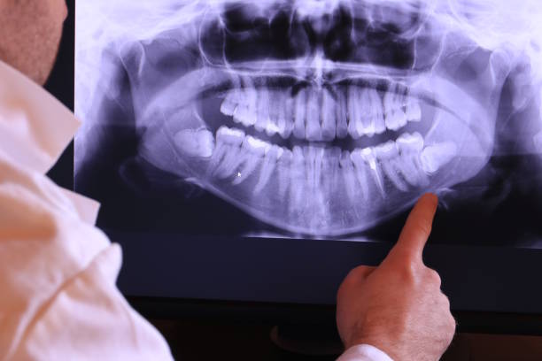 Best Emergency Treatment for Jaw Pain or Injury in Cross Roads, TX