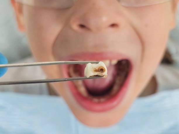 Best Walk-In Emergency Dental Services in Cross Roads, TX
